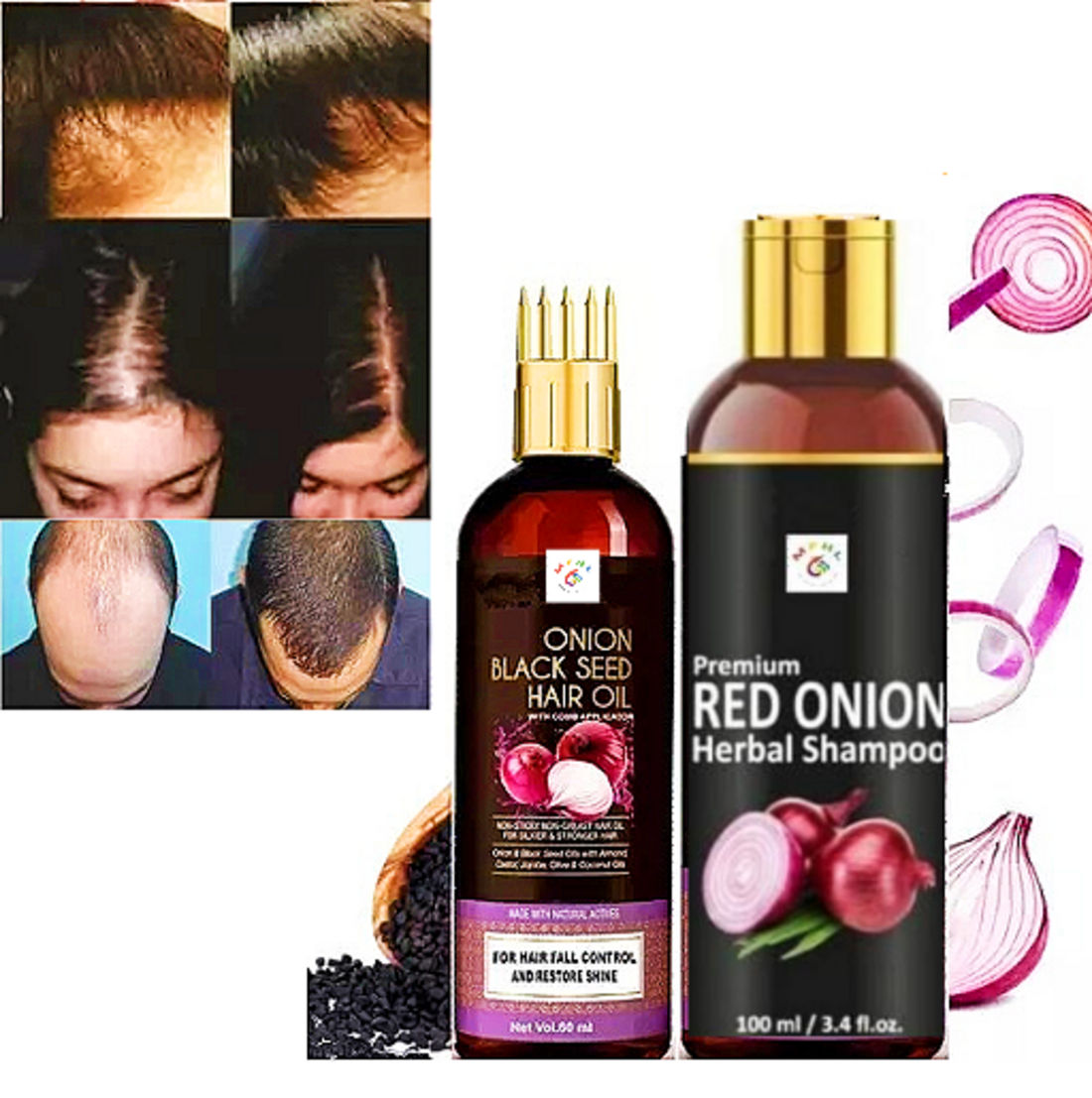 Black Seed Onion Hair Oil + Shampoo for Hairloss Control with comb applicator - Image 10